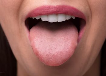 Algunas infecciones bacterianas, como la escarlatina o la sífilis, pueden causar cambios en la lengua, como una apariencia "fresa" o llagas dolorosas. - Fuente externa.